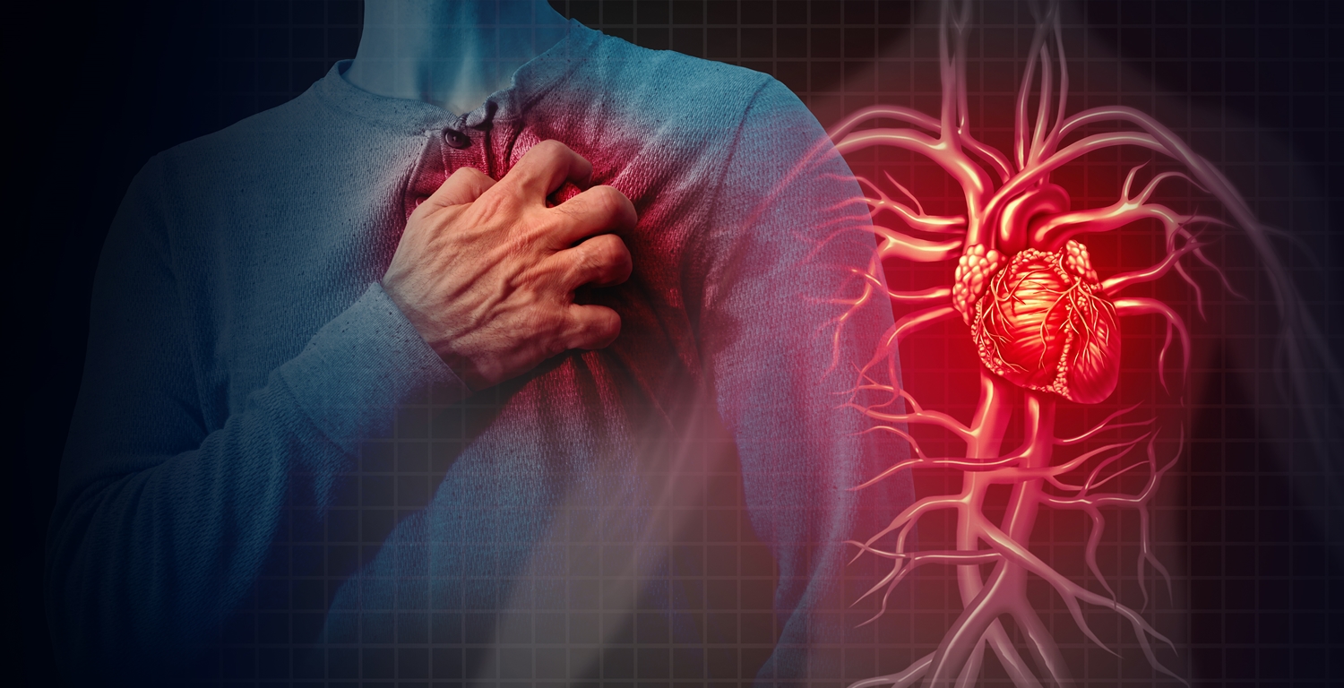 Risikofaktoren für einen Herzinfarkt